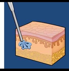Injectables